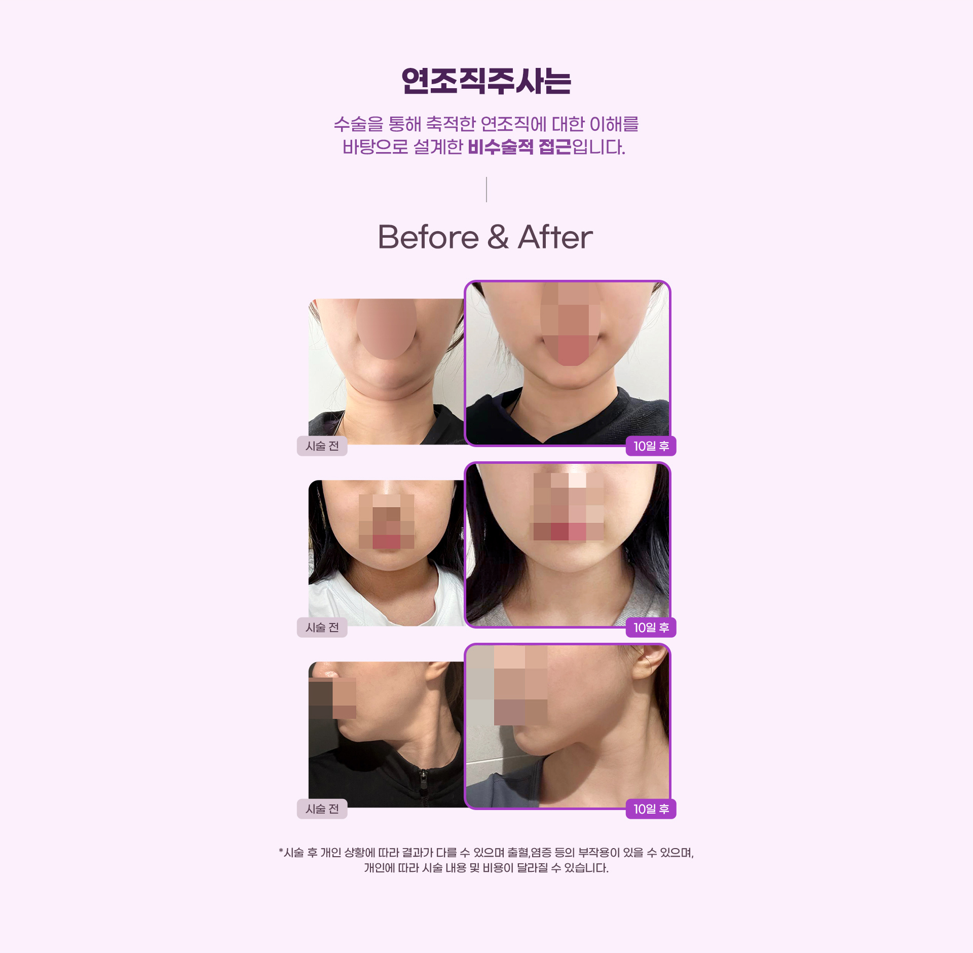 DA연조직주사