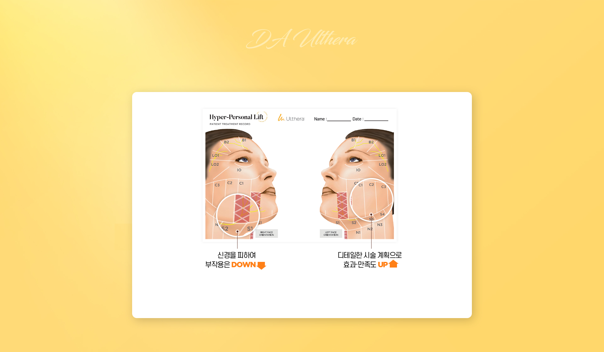 DA첫눈세미아웃