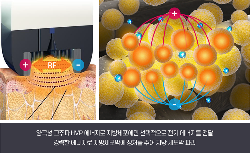 디에이 바디 인모드