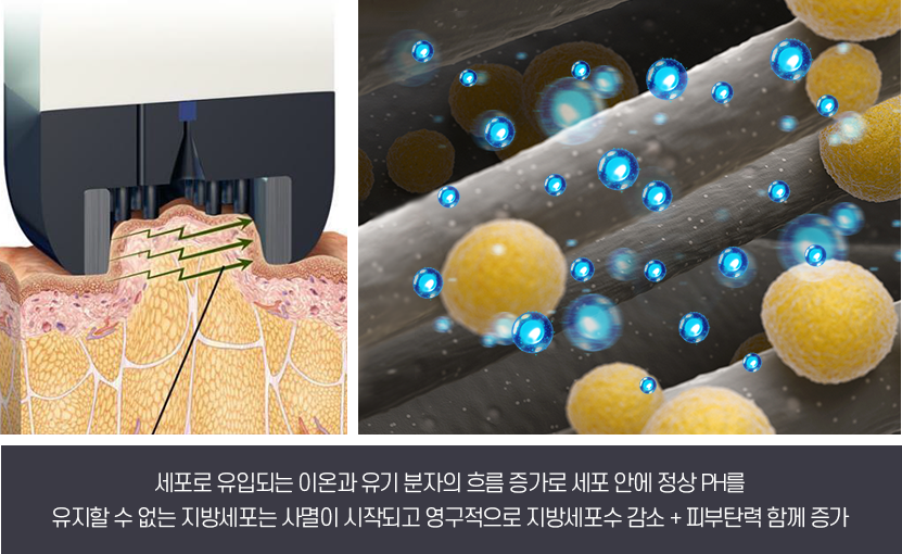 디에이 바디 인모드